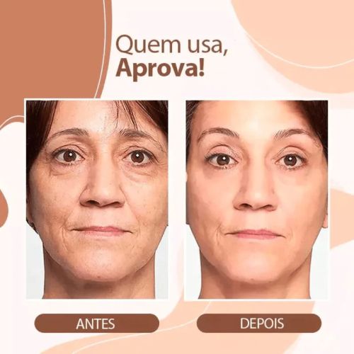 DermaLift - Até 10 anos mais jovem! - Pague 1 Leve 2 - Últimas unidades